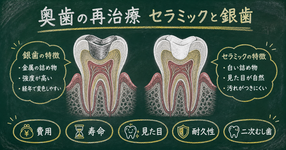 奥歯の再治療はセラミック？銀歯？費用や寿命など5基準で比較