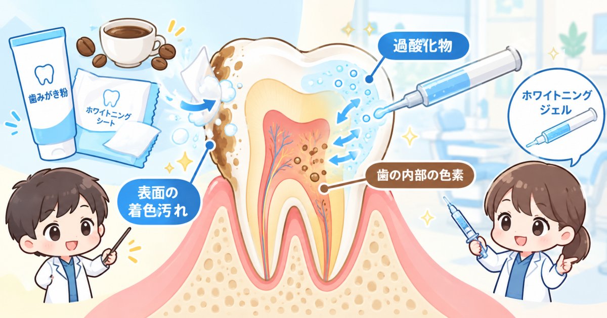 市販品とクリニックのホワイトニングは効果や作用の仕組みがどう違うのか